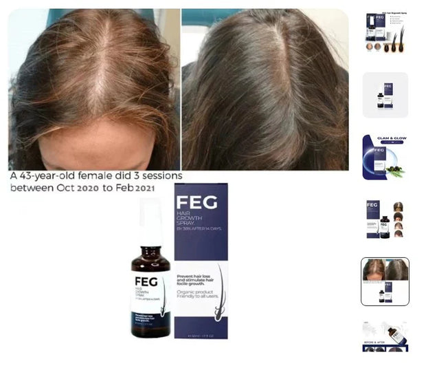 FEG Hair Growth Spray With  Derma Roller Free