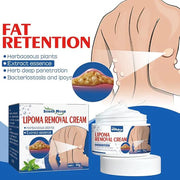 MFGMF LipoPRO Instant Lipoma Removal Cream, Lipoma Removal Cream, South Moon LumpFree Lipoma Removal Cream, 50g (1PCS)