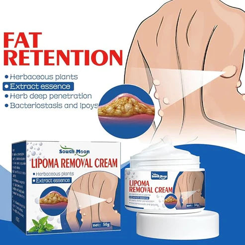 MFGMF LipoPRO Instant Lipoma Removal Cream, Lipoma Removal Cream, South Moon LumpFree Lipoma Removal Cream, 50g (1PCS)