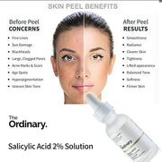 Salicylic Acid 2% Solution 30 ml (Original)